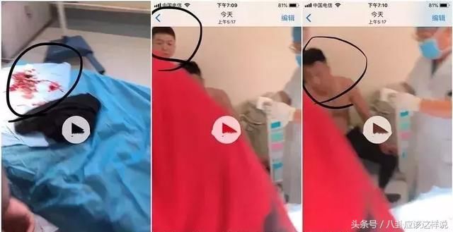 “开云电竞app下载安装”炎炎夏日 这样洗澡赶走6种小病 同时洗澡最容易犯的6个错误 一起来看看吧!(图3) 开云电竞官网